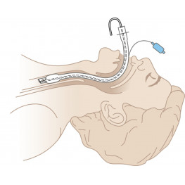 Endotracheal Tube Holder