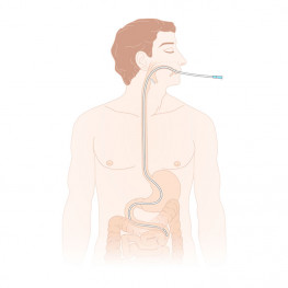 Duodenal Tubes