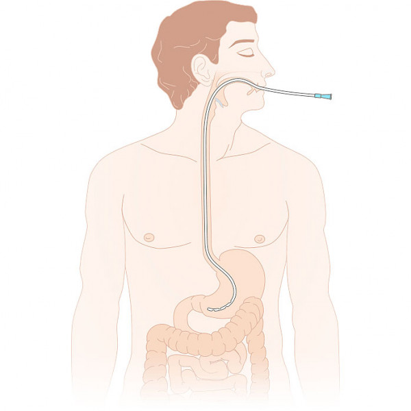 Stomach tubes scheme