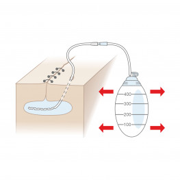 Silicone Wound Drainage Reservoirs