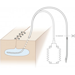 Perforated Silicone Round Drain