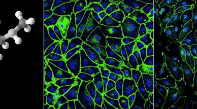 Fluidically linked blood-brain barrier and Organ Chips offer new method for studying effects of drugs on the brain